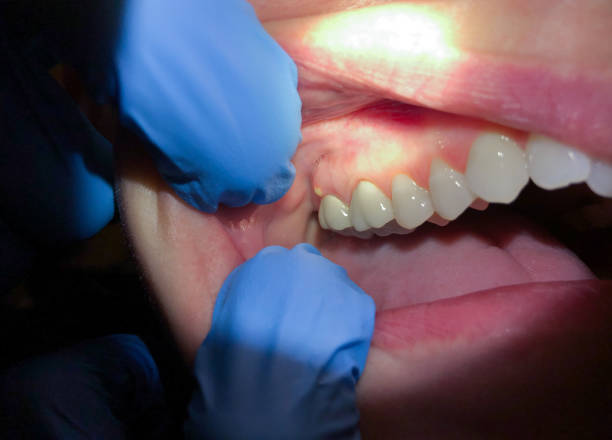 Best Emergency Dental Surgery in Farley, KY